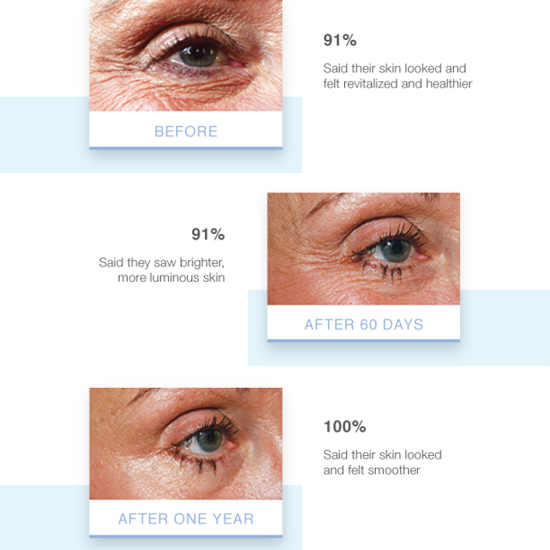 Elevate Eye Serum - Reduces Puffiness and Dark Circles - 0.5 oz 15 mL